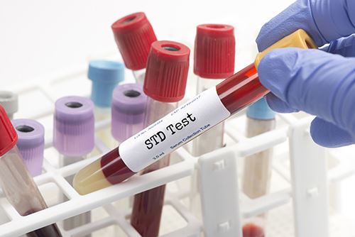 Blood Vial for Sexually Transmitted Disease Testing